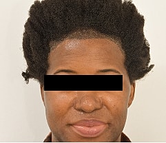 Gender Affirming Hair Before & After