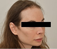 Gender Affirming Hair Before & After