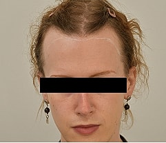 Gender Affirming Hair Before & After