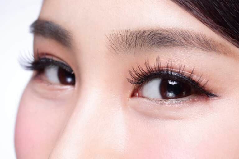 Botox Improves Crow’s Feet Lines