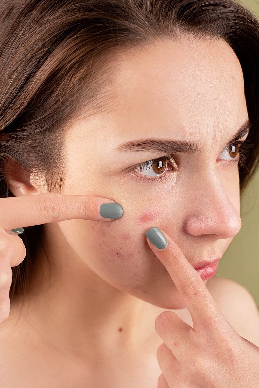 Problematic and Sensitive Skin Solutions