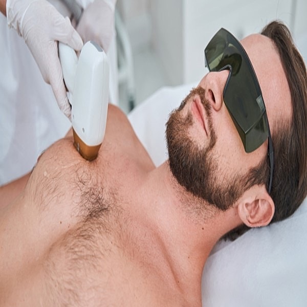 Laser Hair Removal Treatment for Men Safe & Effective Results