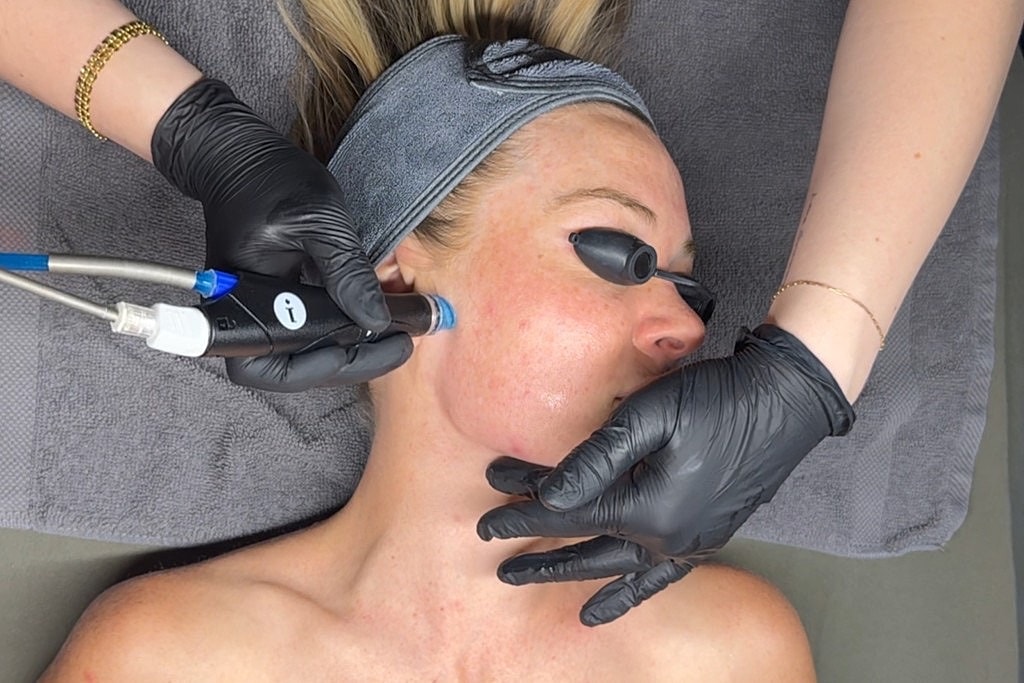 Hydrafacial
