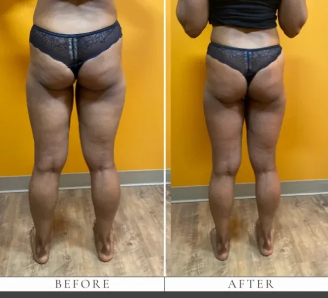  Before & After