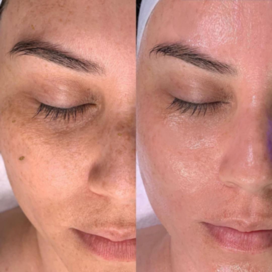  Before & After