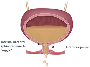 bladder