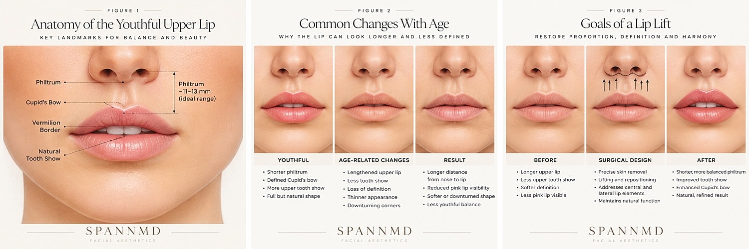 Lip anatomy, aging effects, and lift goals.