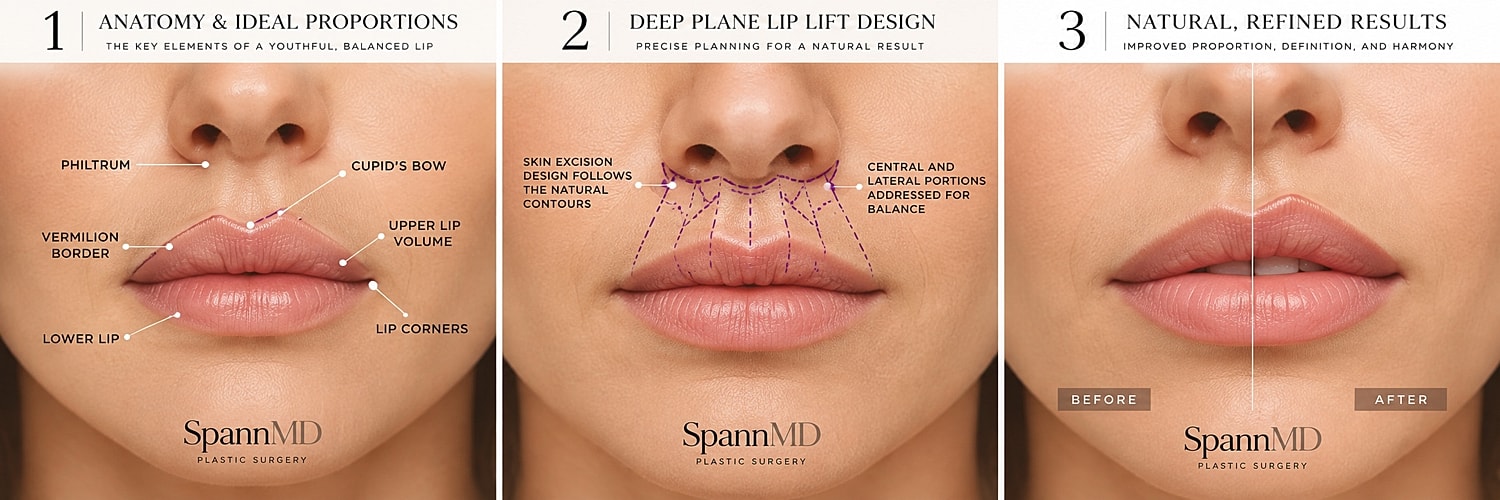 Lip enhancement procedure overview and results.