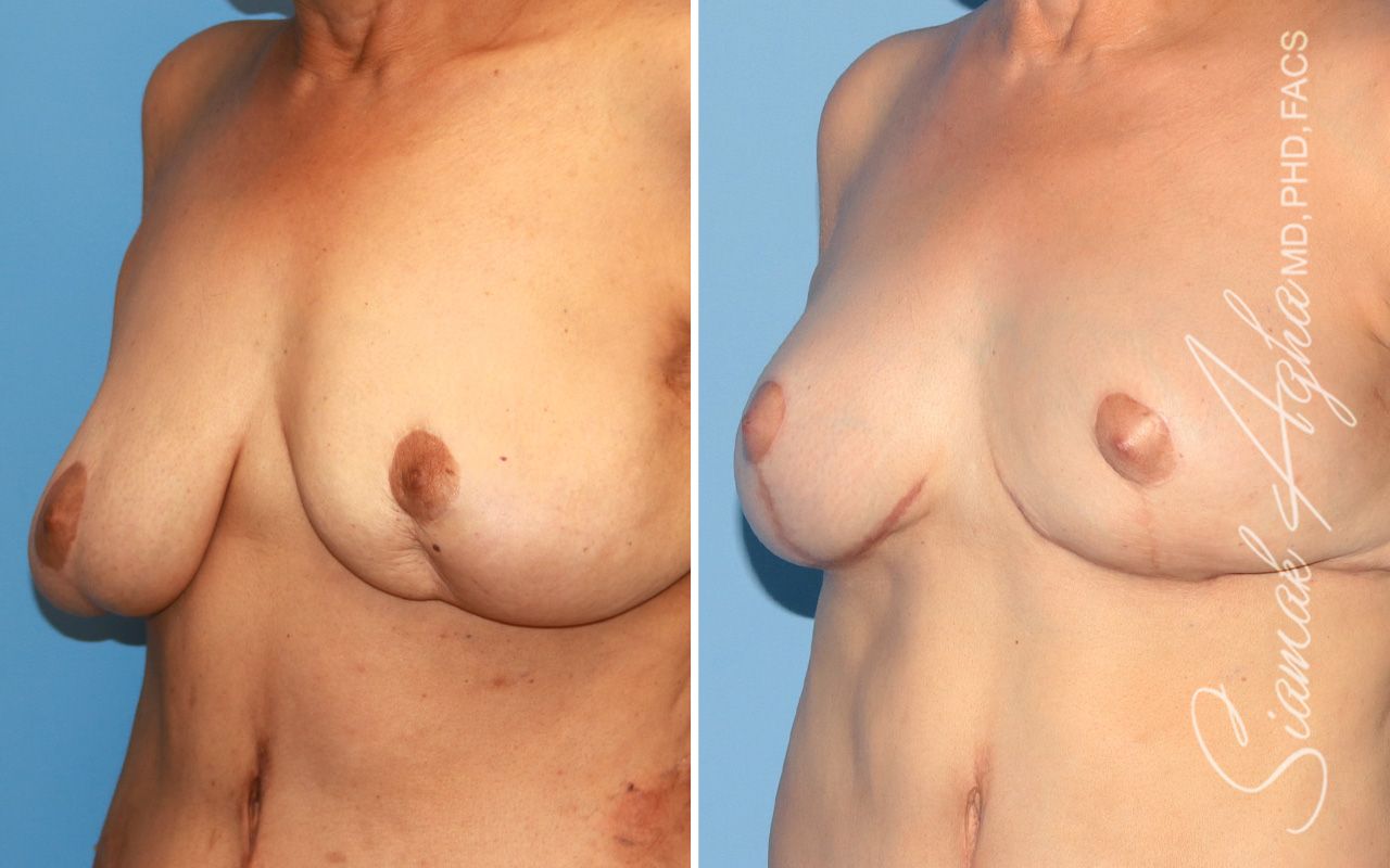 Reconstructive Gallery Before & After