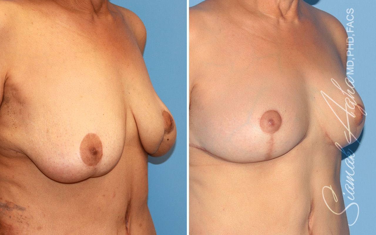Reconstructive Gallery Before & After