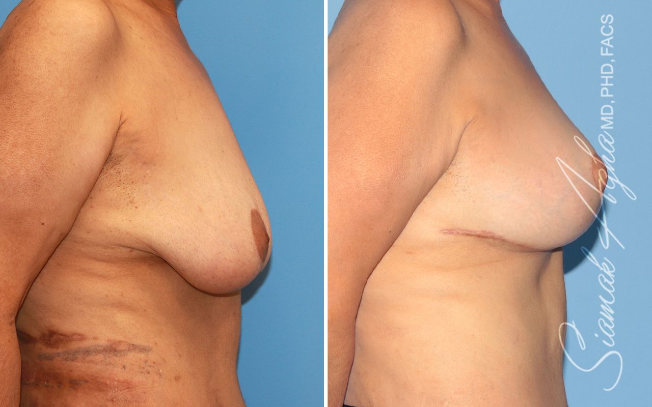 Reconstructive Gallery Before & After