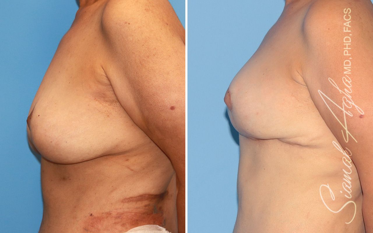 Reconstructive Gallery Before & After