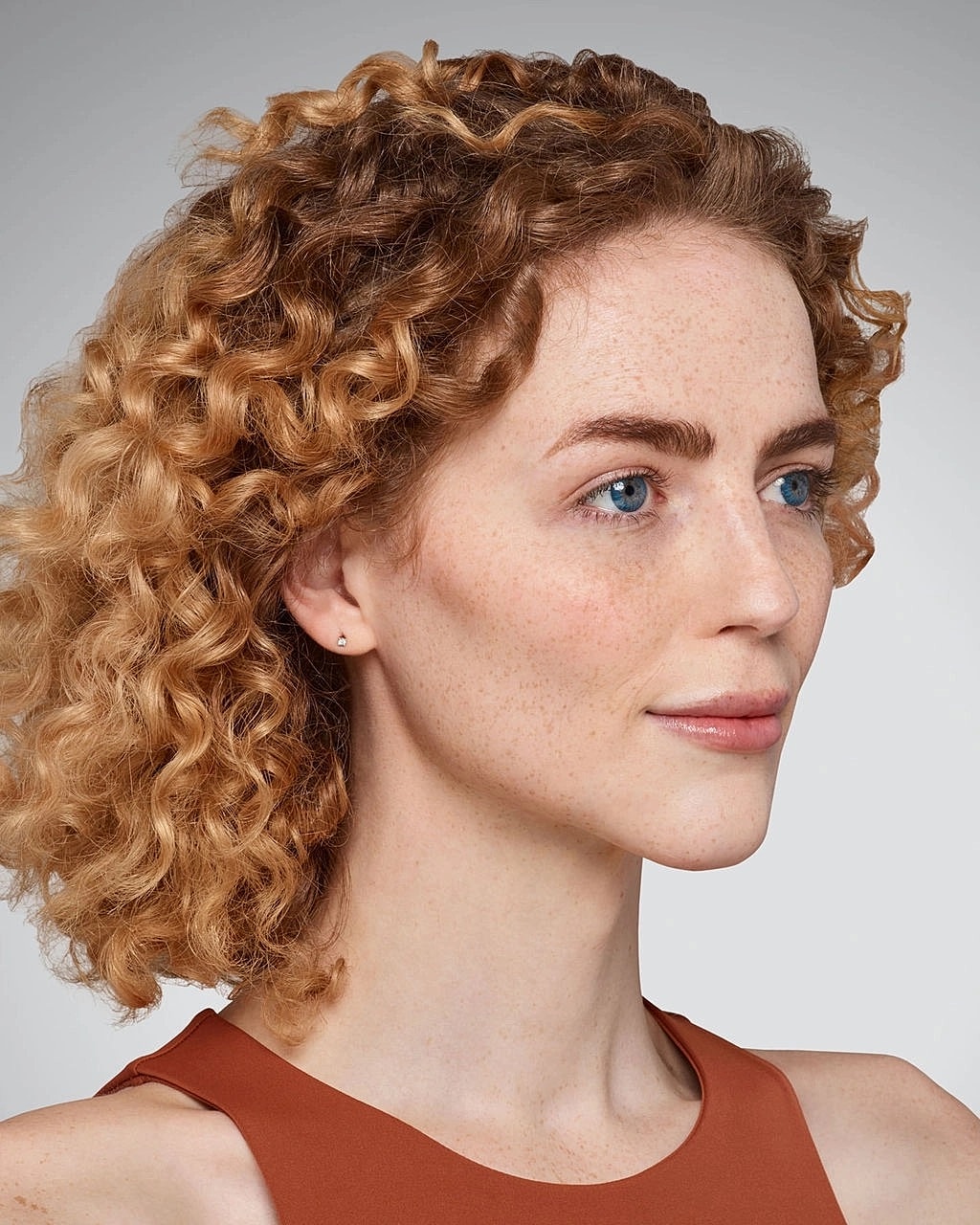 Juvederm Gallery Before & After