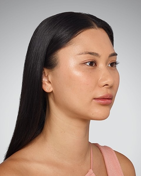 Juvederm Gallery Before & After