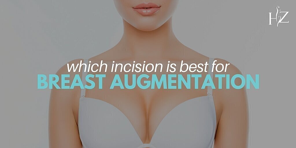 breast augmentation patient model in a bra