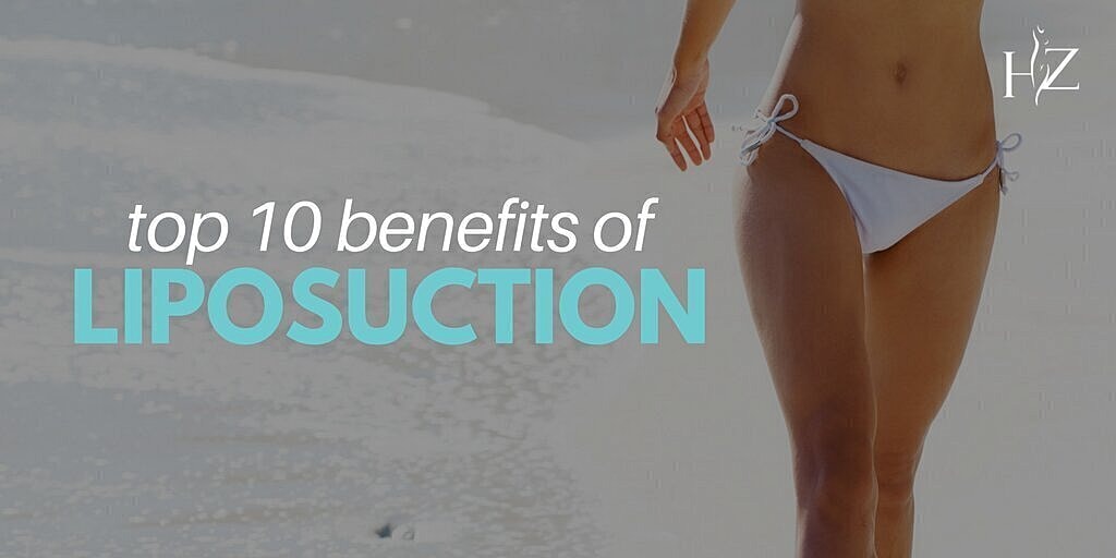 Top 10 Benefits of Liposuction, benefits of liposuction, liposuction Orlando