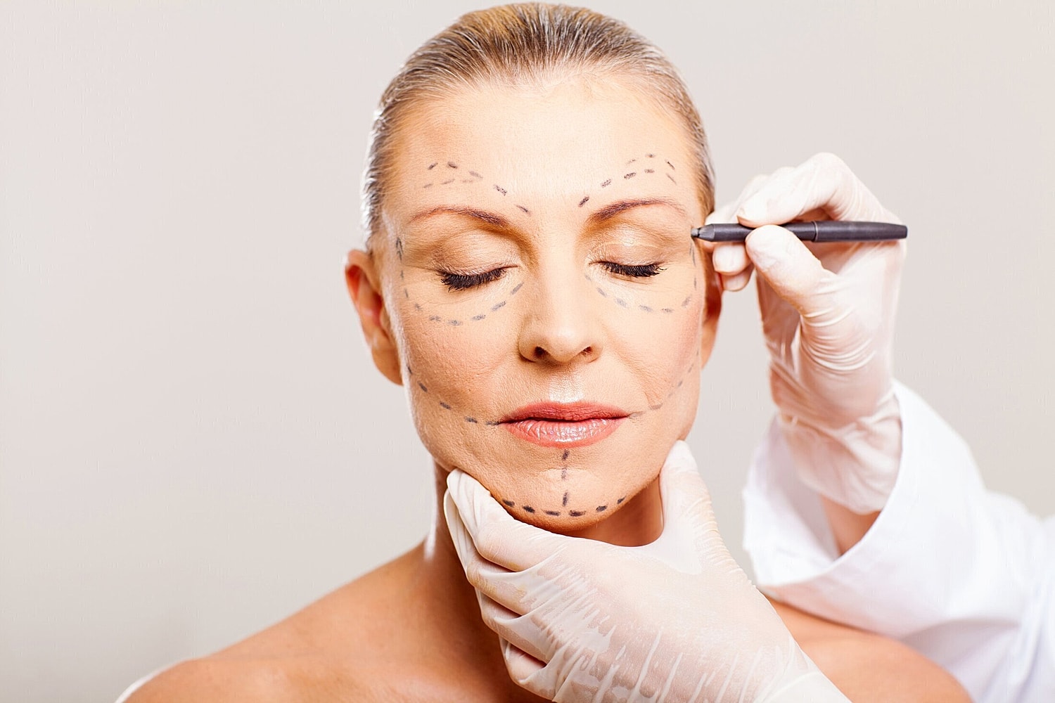what is a brow lift, what is a face lift, how does a brow lift work, how does a face lift work, brow lift vs. face lift, should I get a brow lift or a face lift, brow lift orlando, face lift orlando, orlando brow lift surgeon, orlando face lift surg…
