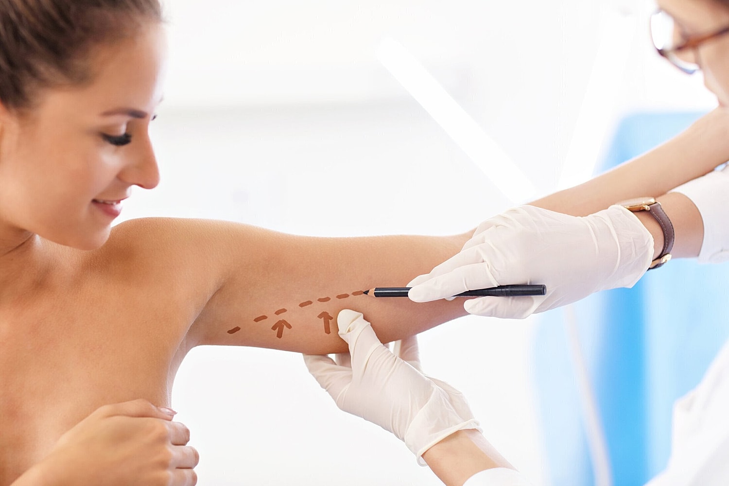 arm lift patient model getting her arm marked out for surgery