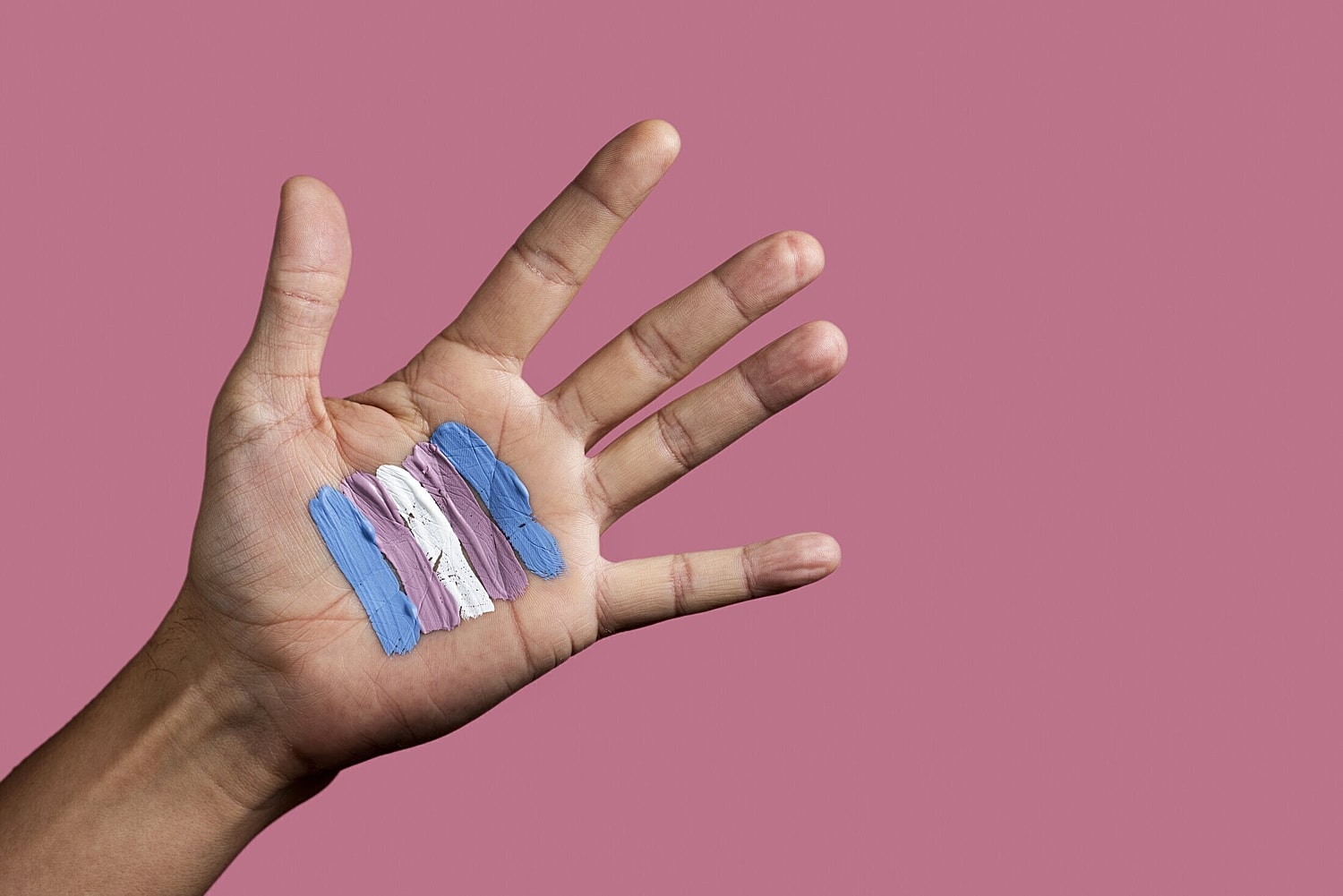 top surgery patient models hand with paint on it