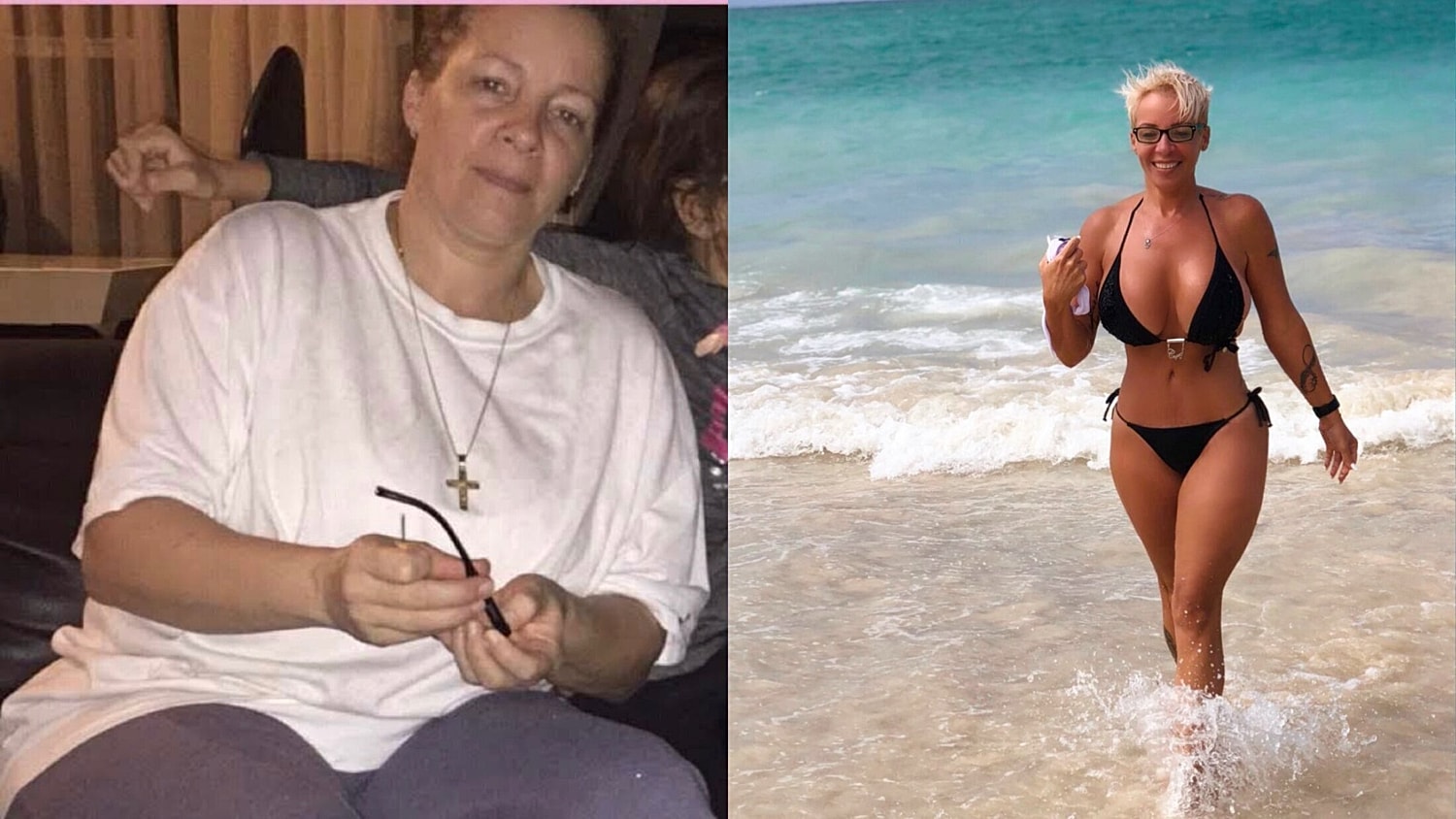 vado plastic surgery patient before and after