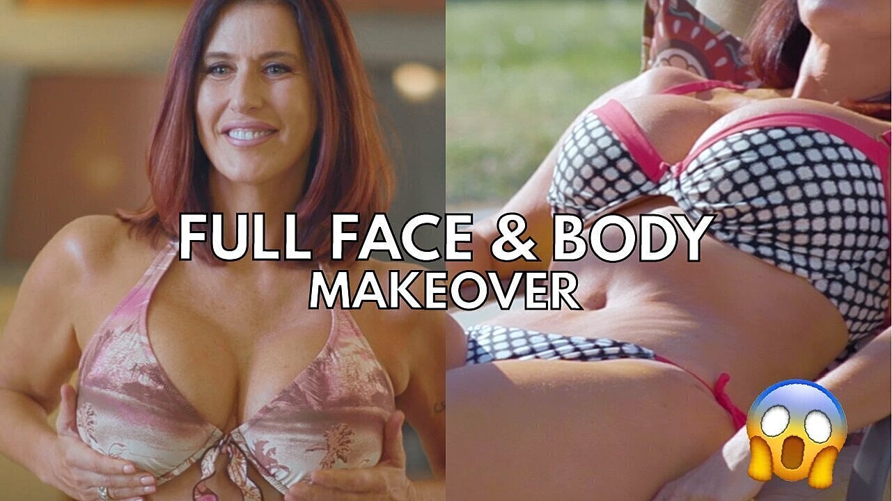 Xena Miller | Face & Neck Lift, Tummy Tuck, Breast Lift with Implants, BBL