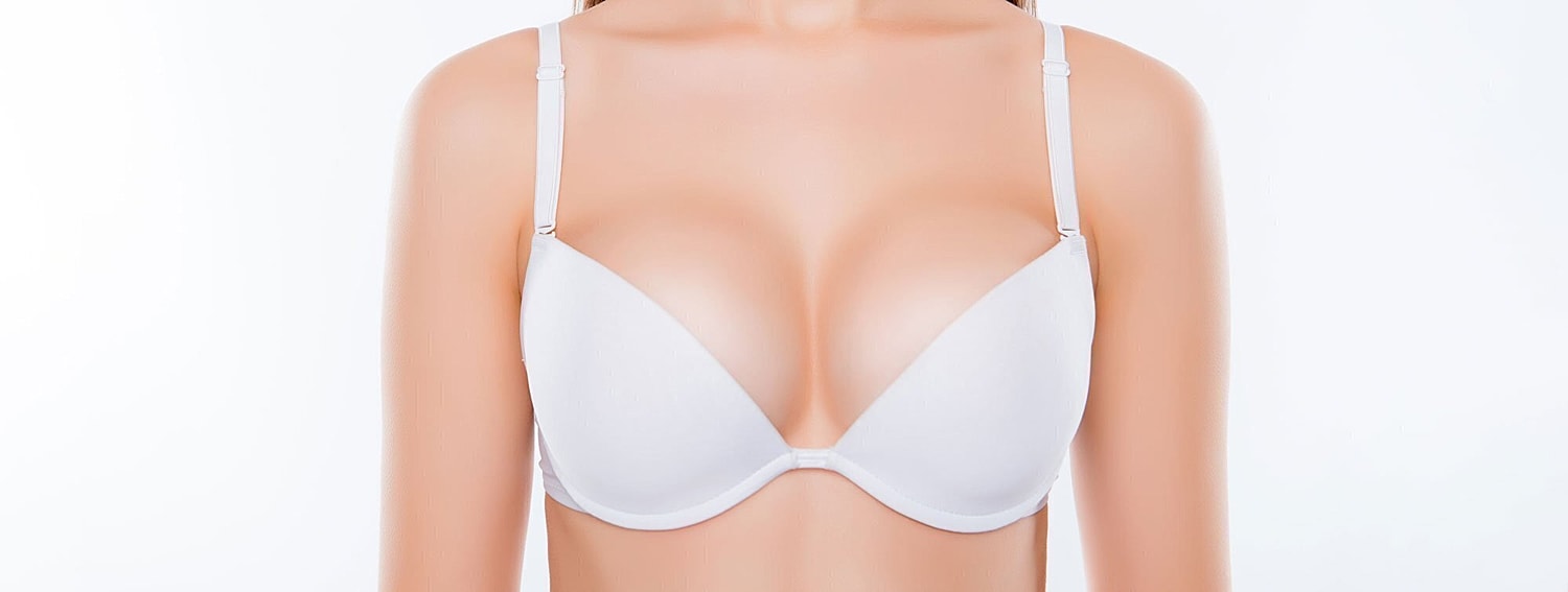 breast augmentation patient model in a white bra