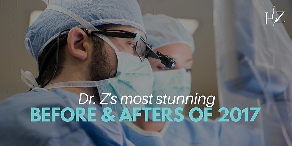 plastic surgery orlando, plastic surgeon orlando, plastic surgery before and afters