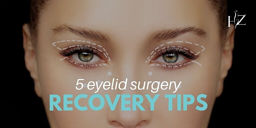 eyelid surgery patient model with incision markings around her eyes