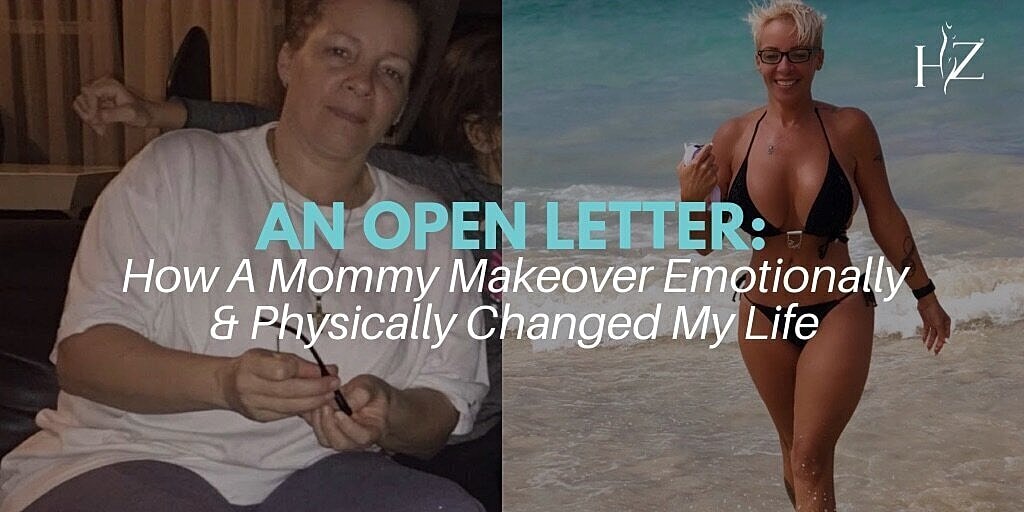 mommy makeover patient before and after 1
