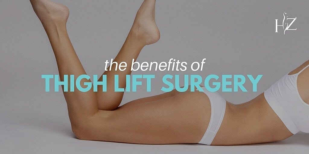 thigh lift, thigh lift surgery, what is thigh lift surgery, how does thigh lift surgery work, who can get thigh lift surgery, what does thigh lift surgery do, thigh lift surgery orlando, thigh lift orlando, thigh lift surgeon, orlando plastic surger…