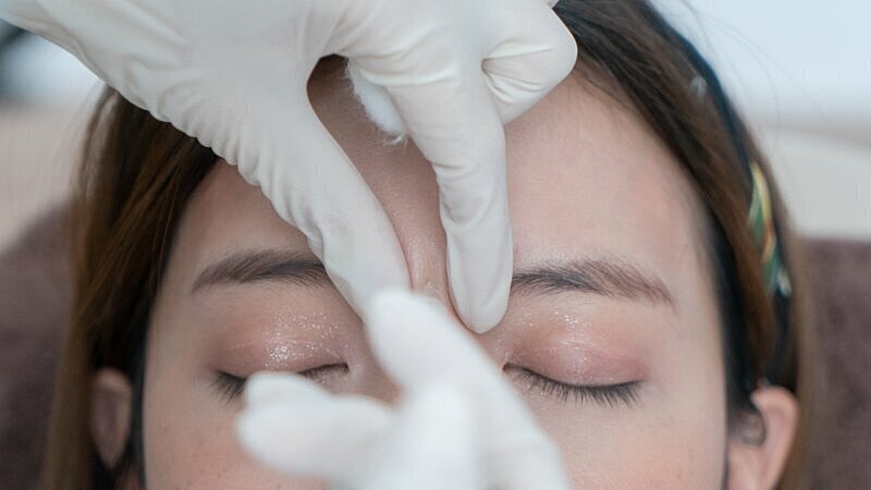 dermal filler patient model receiving an injection