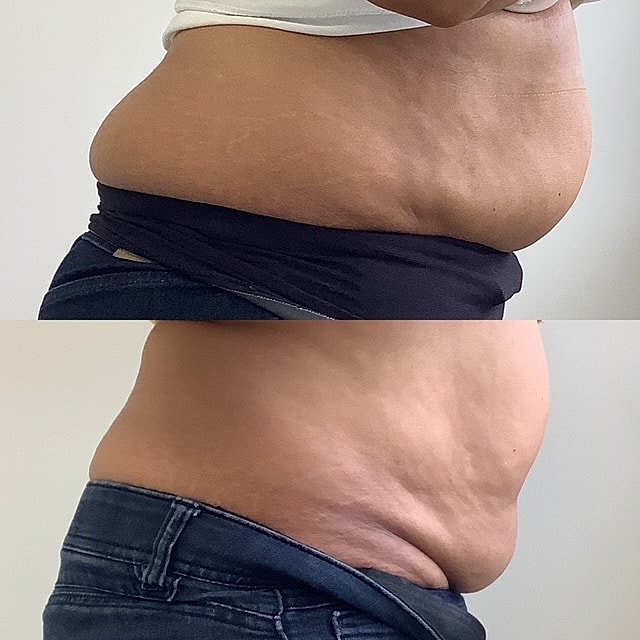 Vanquish ME Before & After