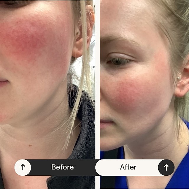  Before & After