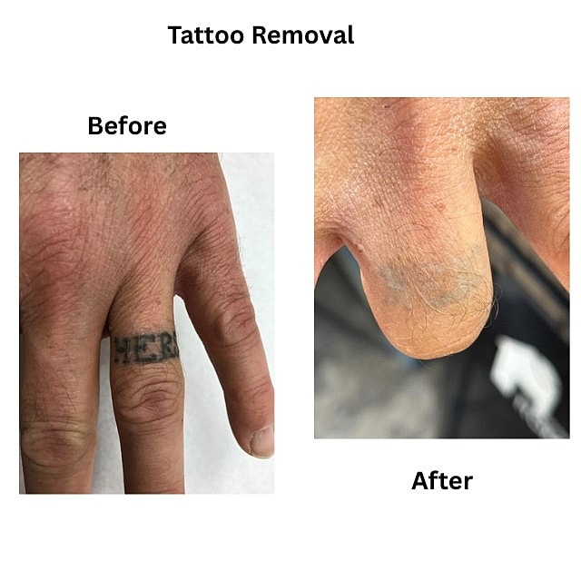 IPL Before & After