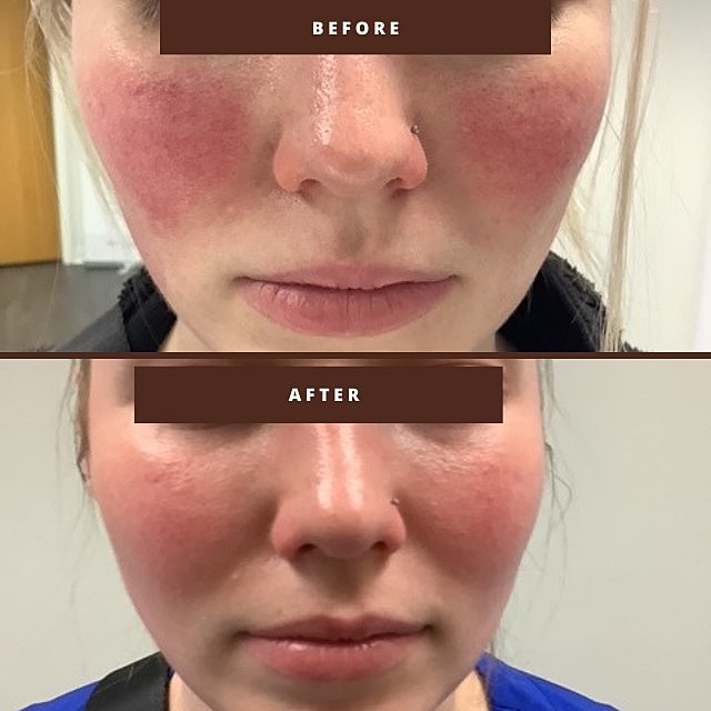  Before & After