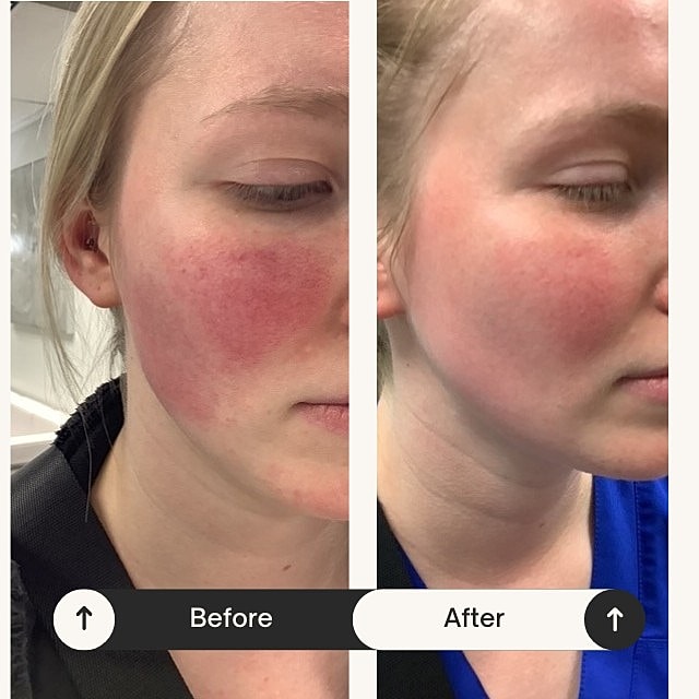  Before & After