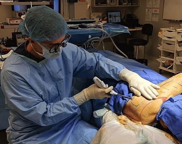 Renuvion treatment Washington DC