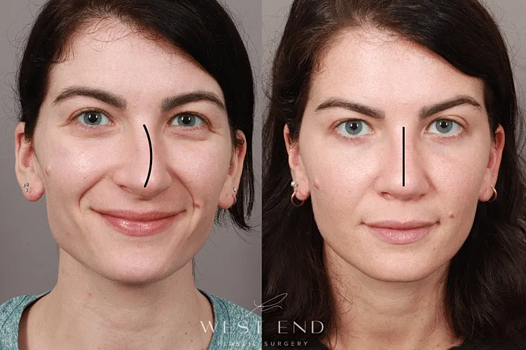 before & after image